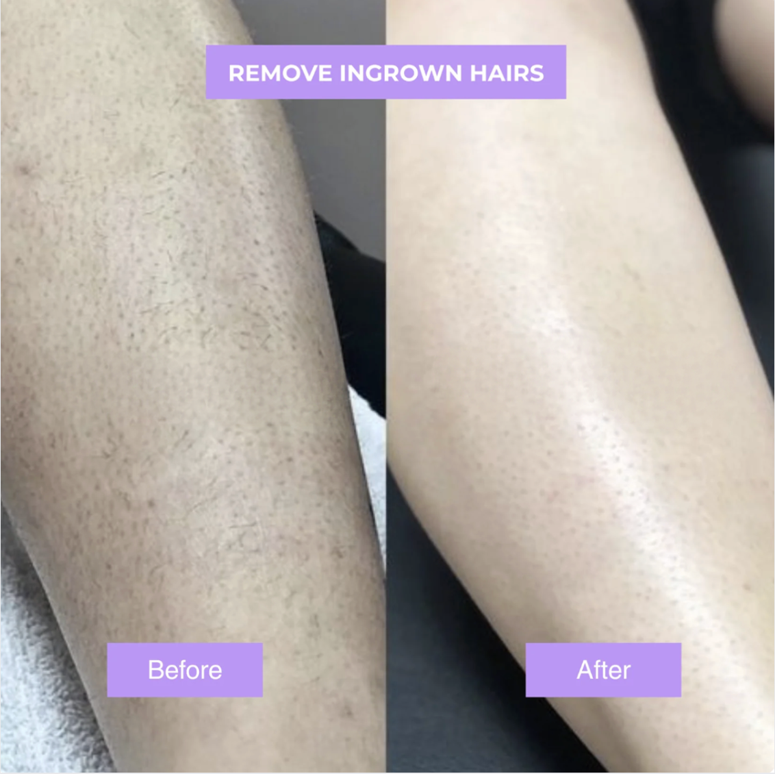 Cyperusglow™ – Cyperus Rotundus Skin Serum